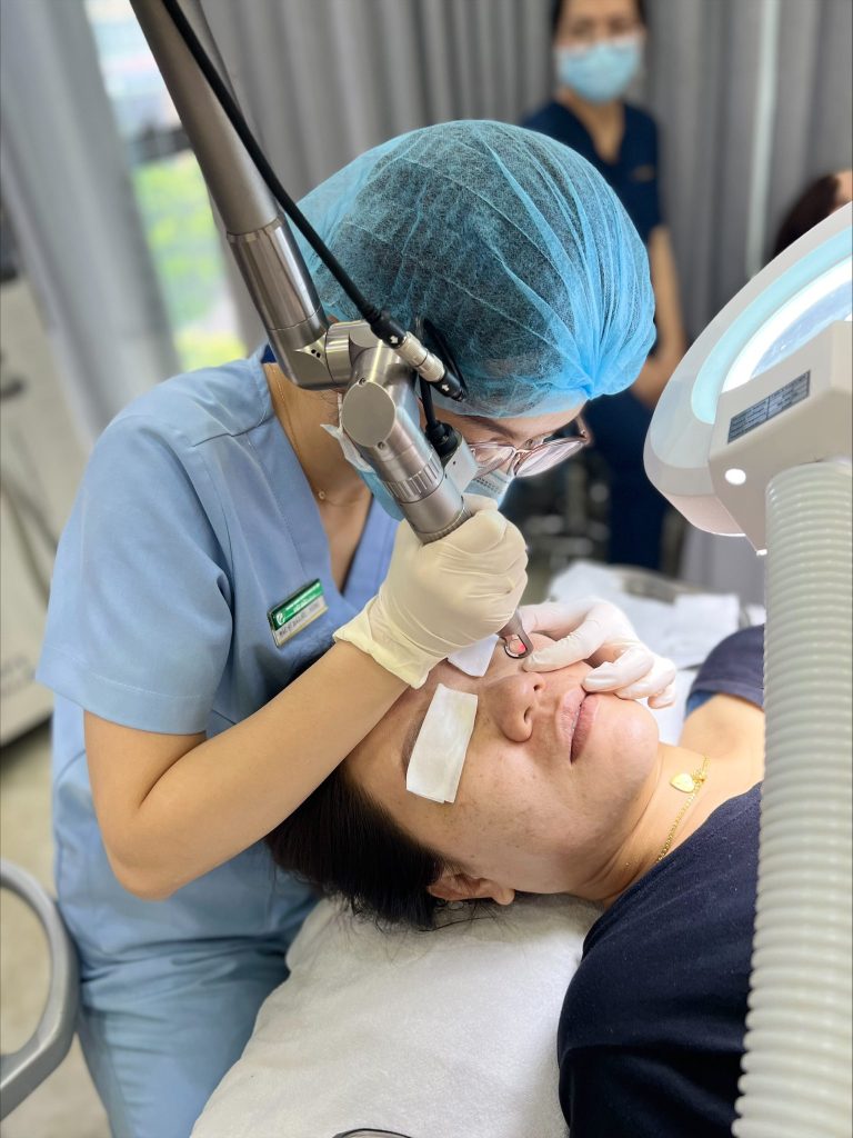Ứng dụng công nghệ Laser trong liệu trình trị nám chuyên sâu