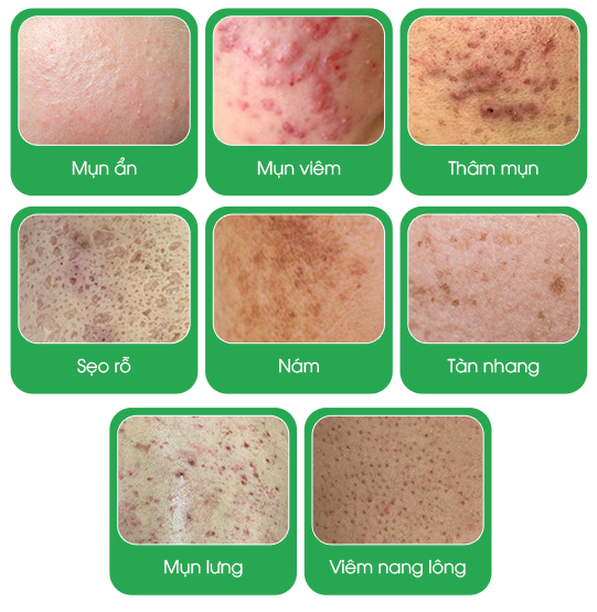Các vấn đề về da