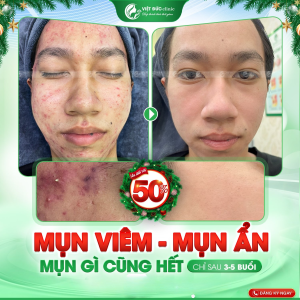 phac-do-tri-mun-viet-duc