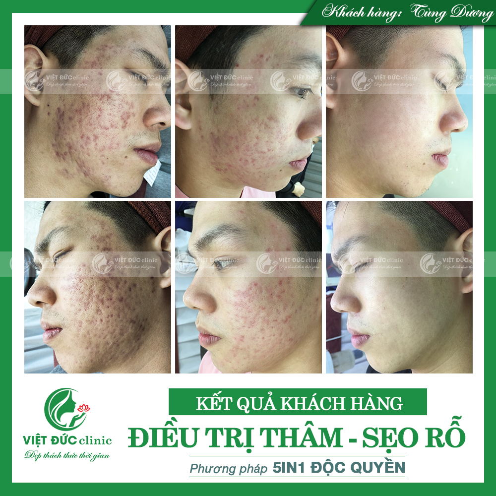 khach-hang-tri-seo-ro-da-lieu-viet-duc