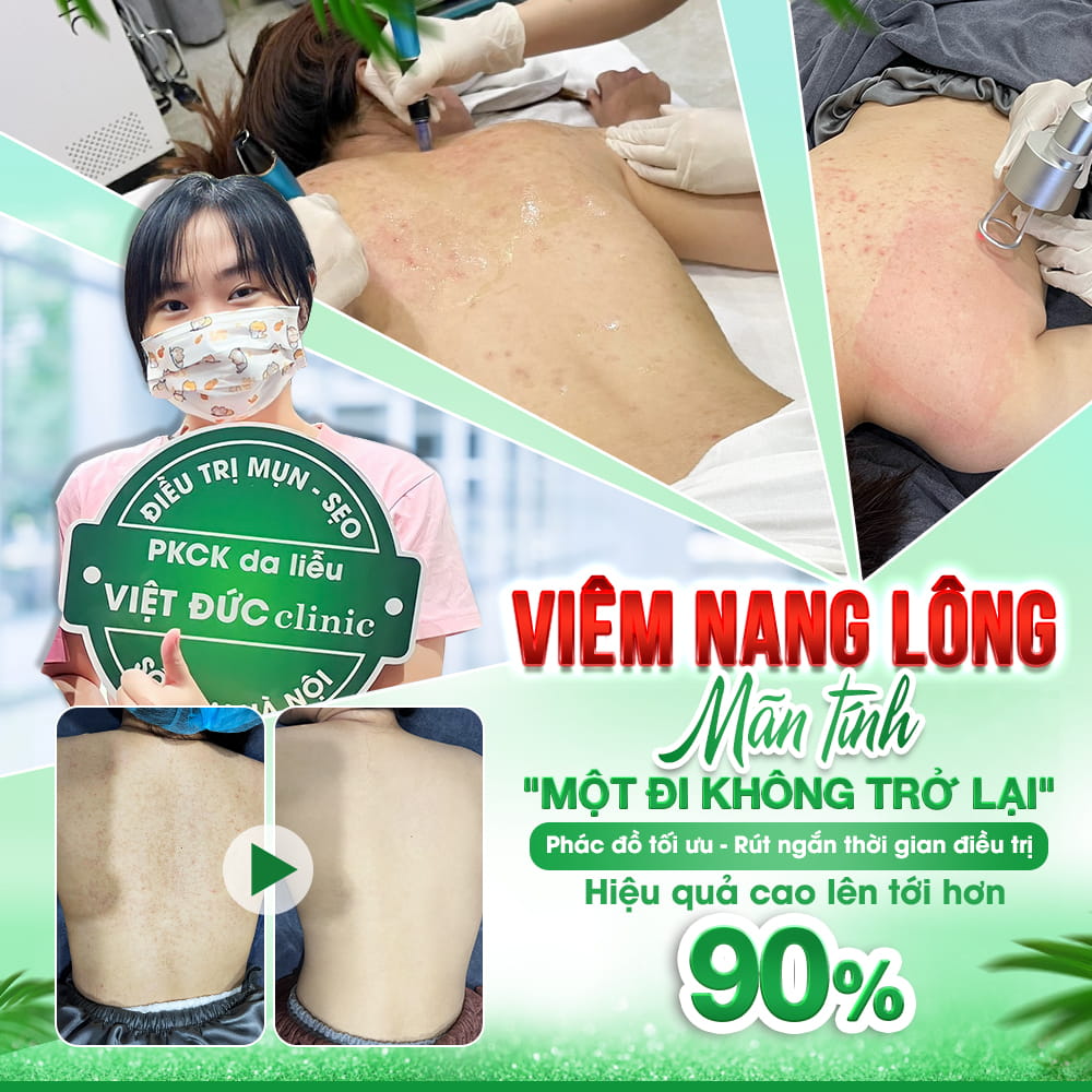 chua-mun-lung-tai-viet-duc-het-lieu-trinh