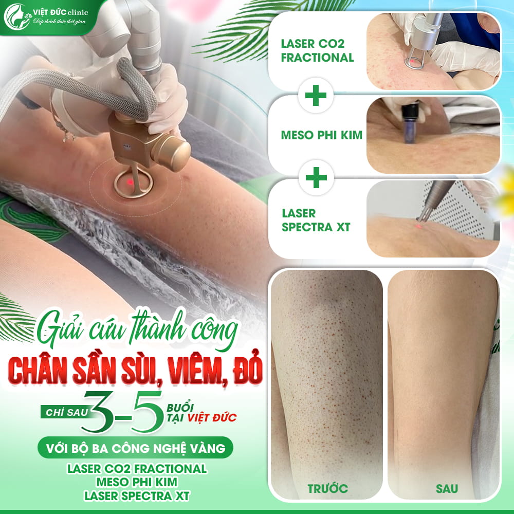 hieu-qua-thuc-te-cach-chua-viem-nang-long-viet-duc