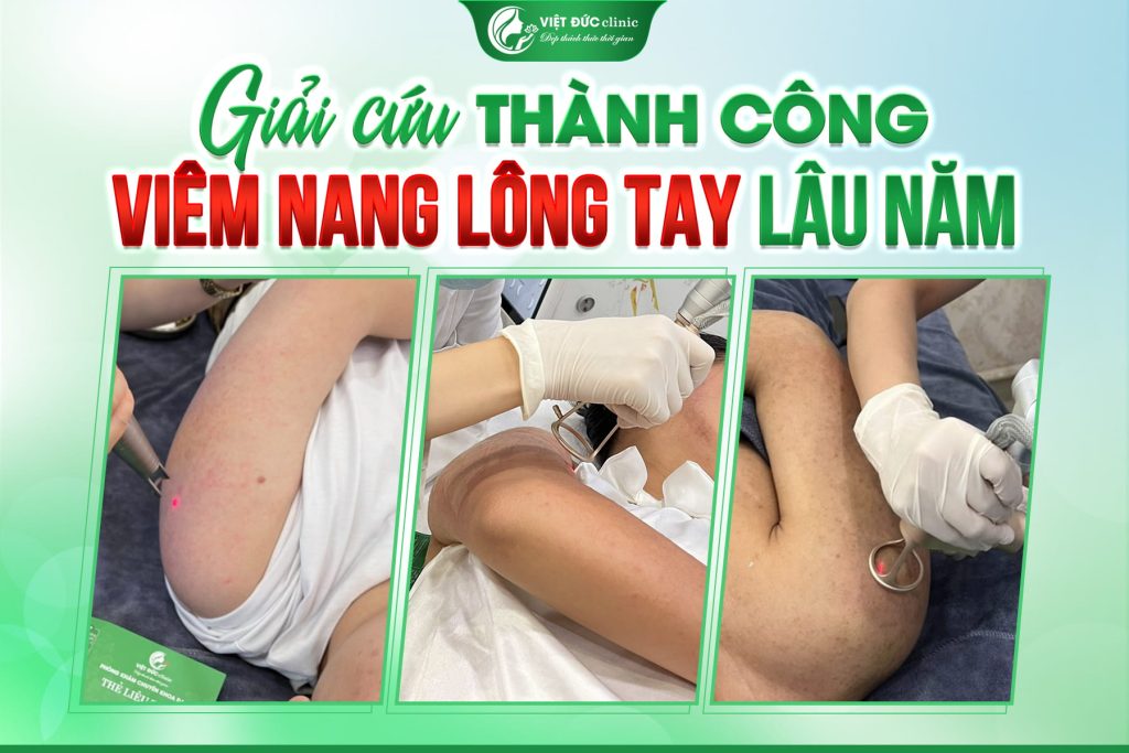 phac-do-kham-day-sung-hay-viem-nang-long-viet-duc