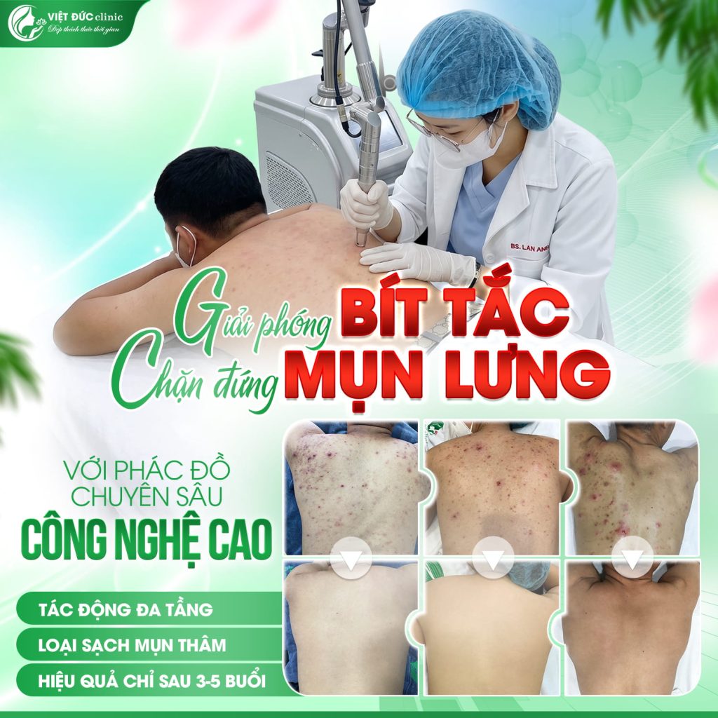 truoc-va-sau-khi-tri-mun-lung-da-lieu-viet-duc