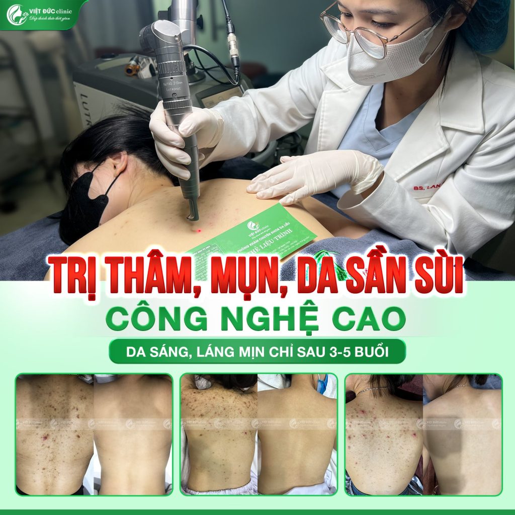 hieu-qua-kham-mun-boc-o-lung-viet-duc