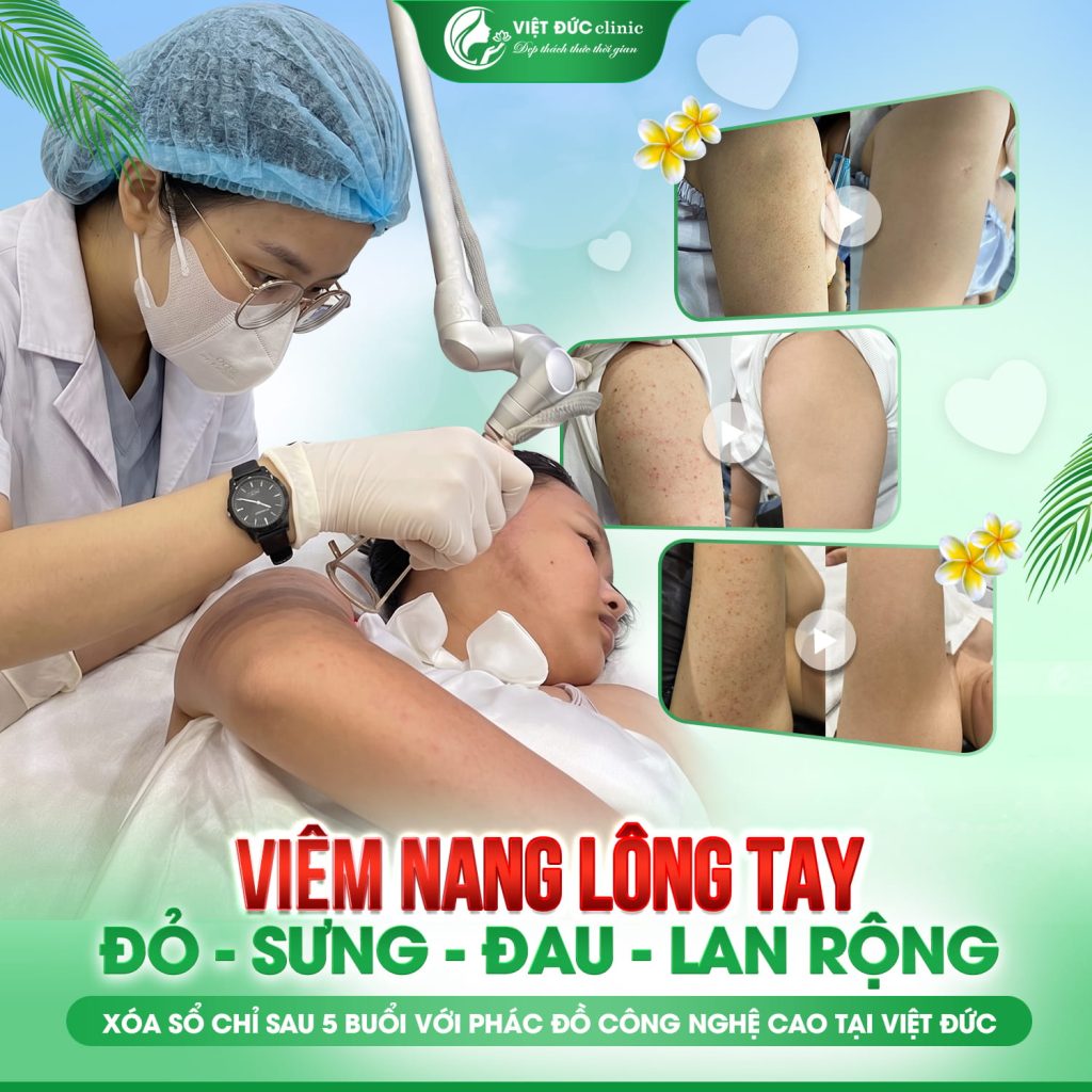 chua-day-sung-nang-long-mua-dong-viet-duc-dung-cach