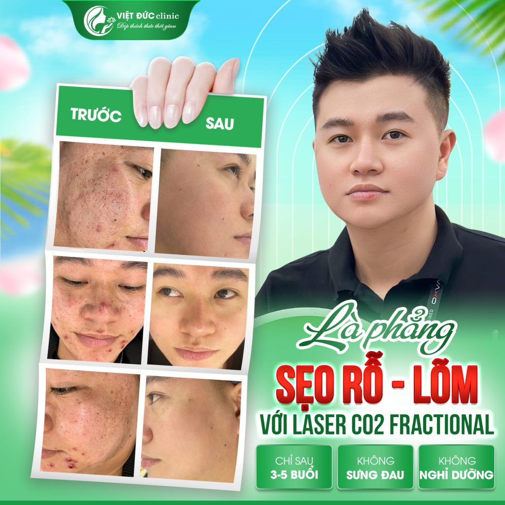 hieu-qua-tri-seo-ro-da-lieu-viet-duc-truoc-va-sau