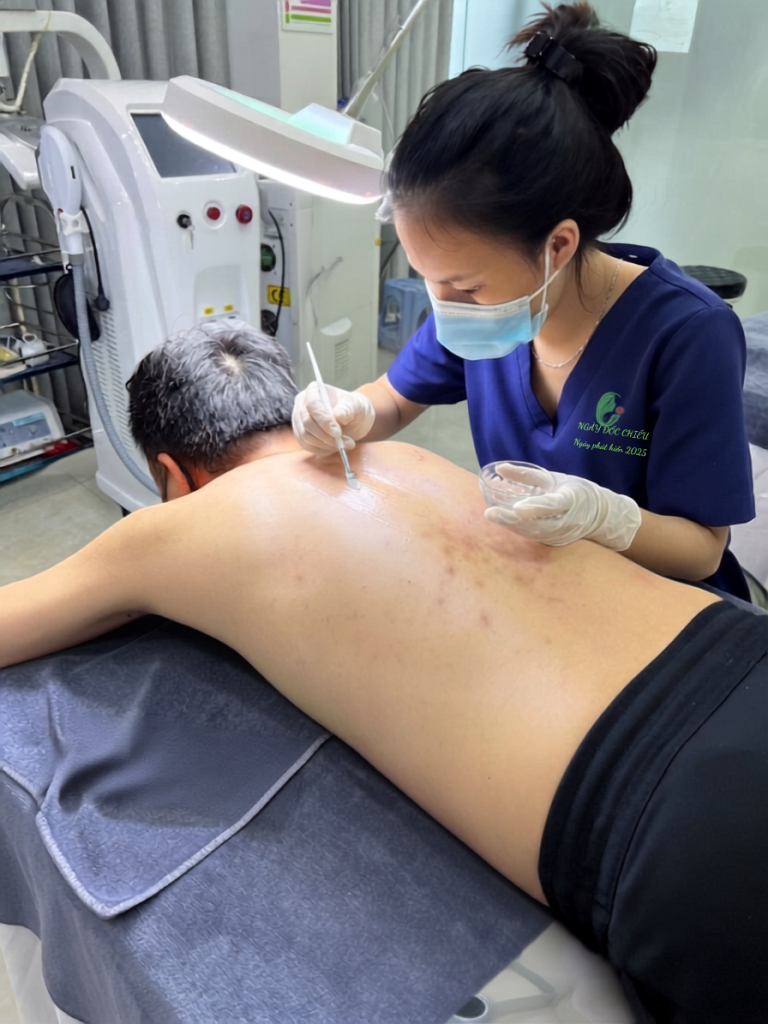 peel-da-day-sung-nang-long-viet-duc-an-toan